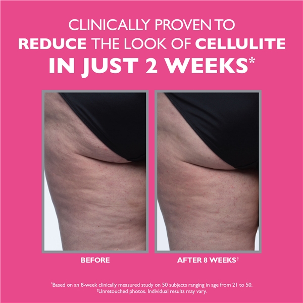 FIRMx® Tight & Toned Cellulite Treatment (Bild 5 av 9)